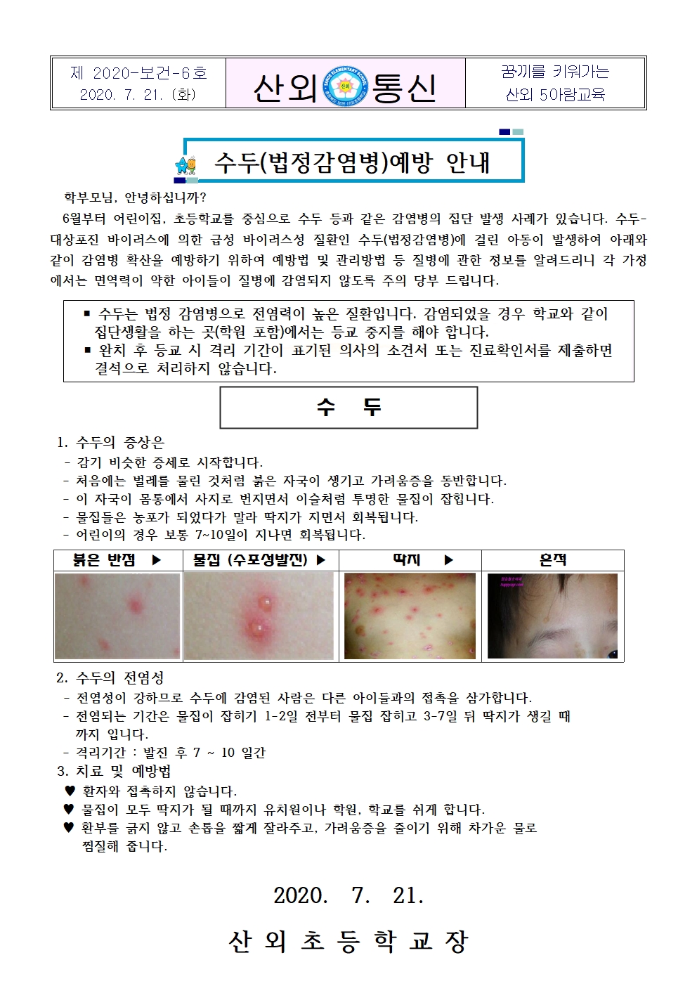 수두(법정감염병)예방 안내문001