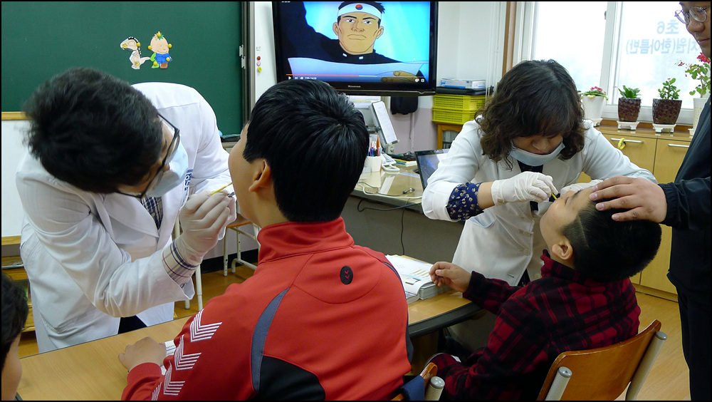 1차 불소겔 도포 - 충치예방 