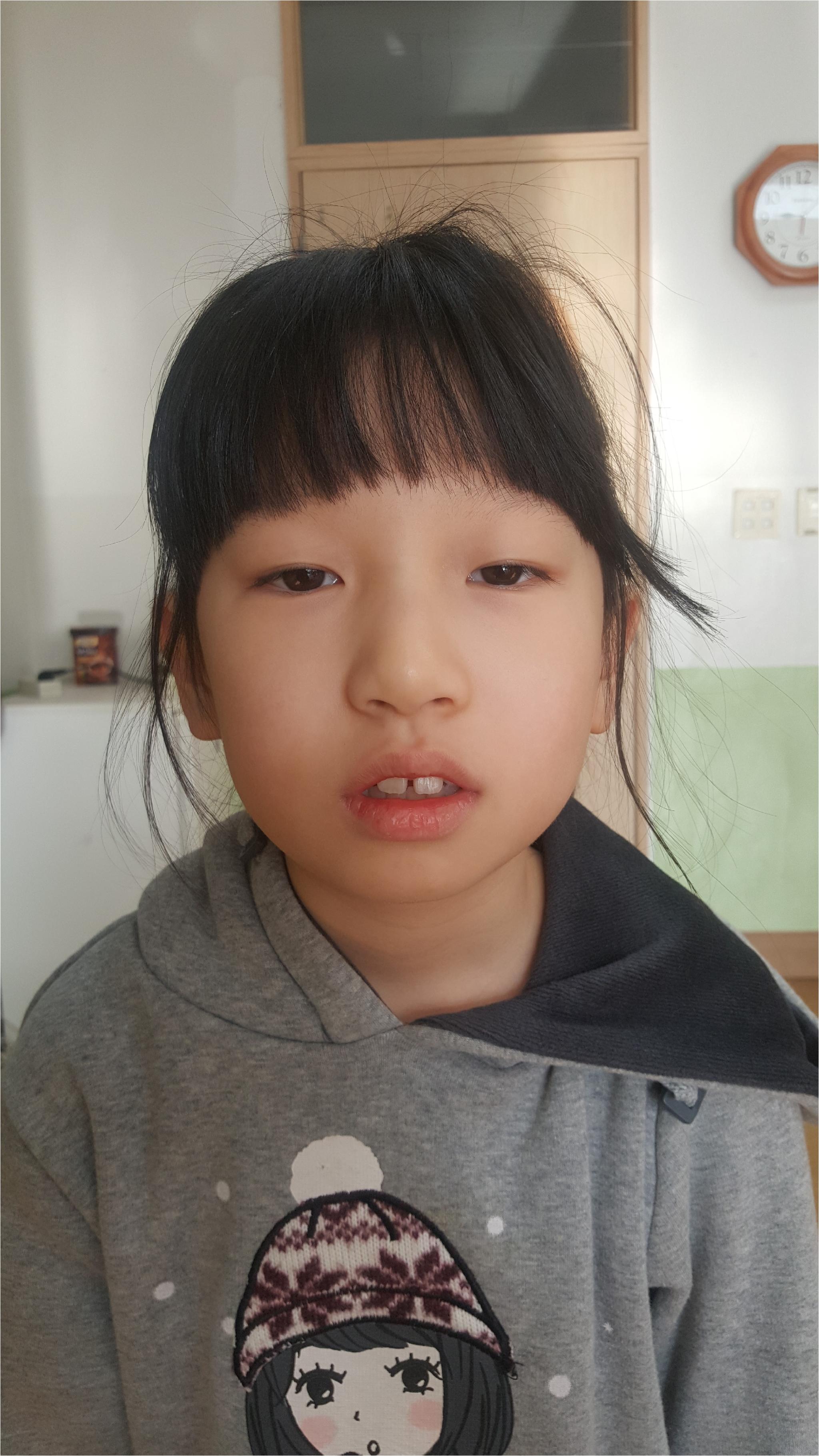 20170303_090827