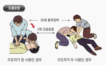 구조자명수 별 인공호흡