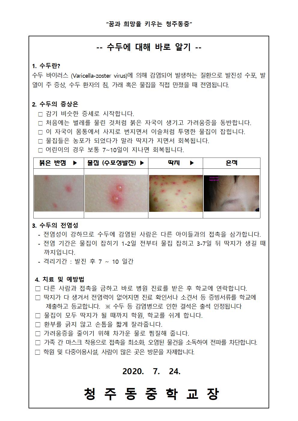 감염병 관련 안내(수인성 및 식품매개, 수두)002