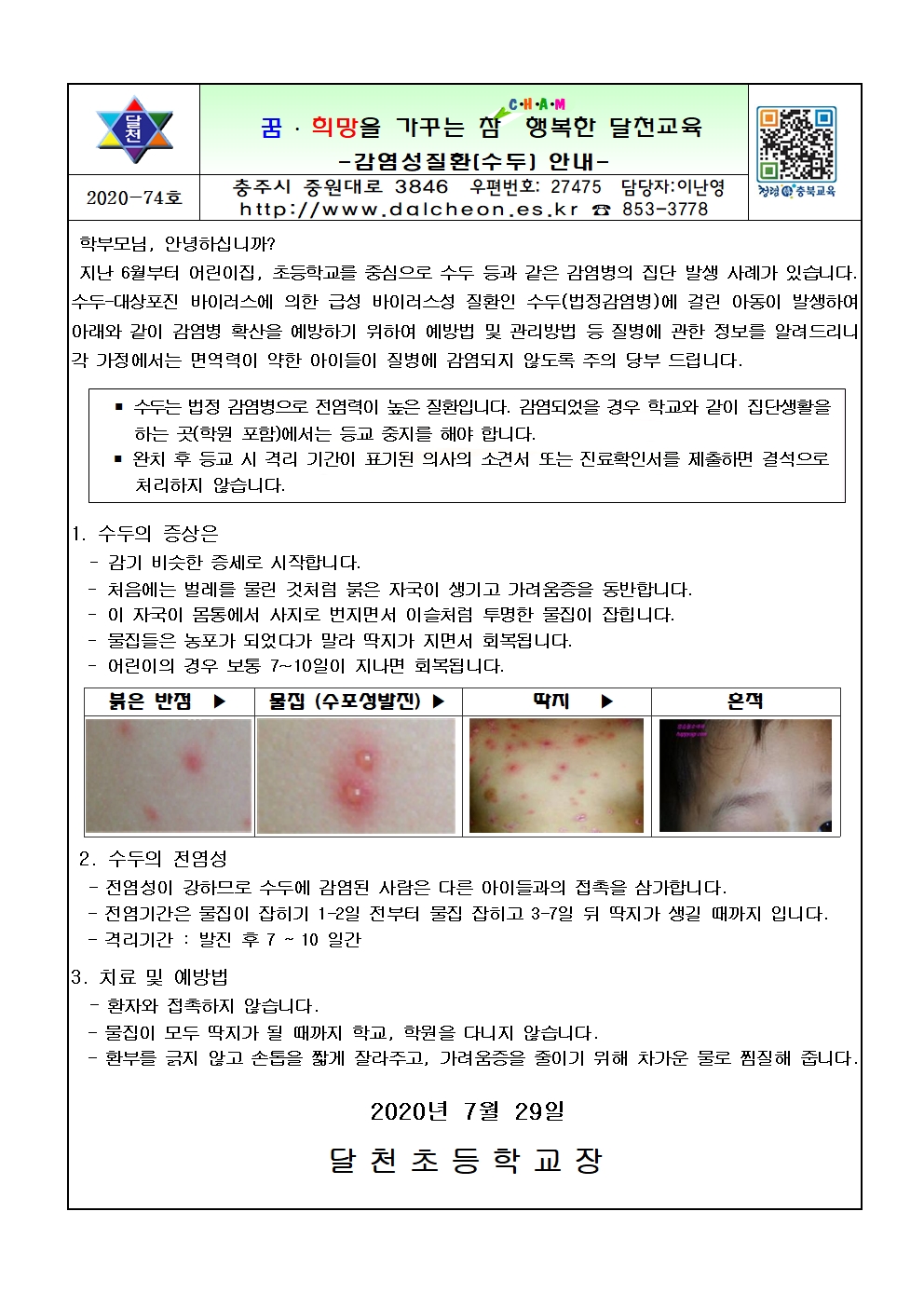 감염성질환(수두) 안내001