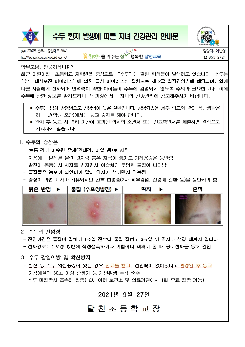 감염성질환(수두) 안내001