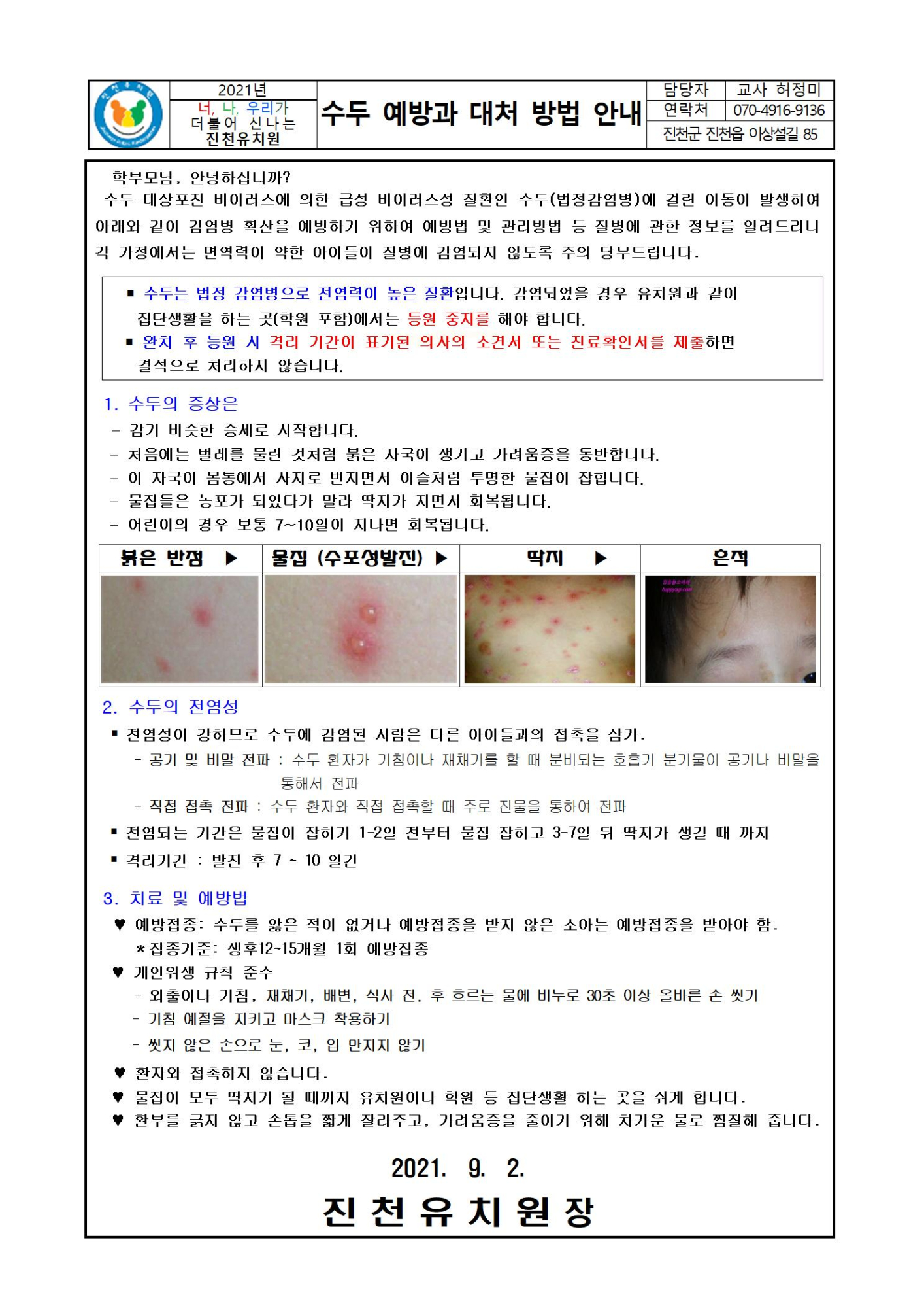 수두 예방과 대처방법 안내001