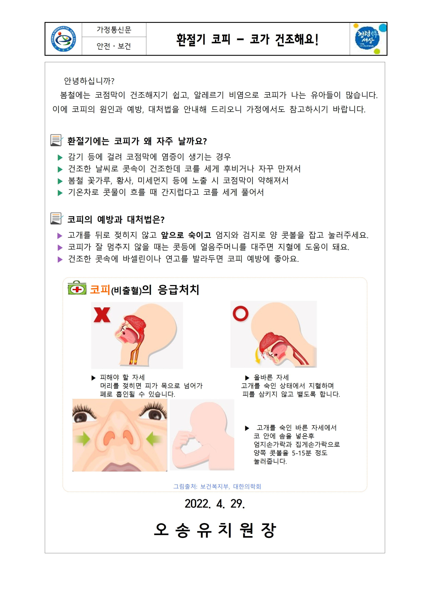 환절기 코피 - 코가 건조해요001