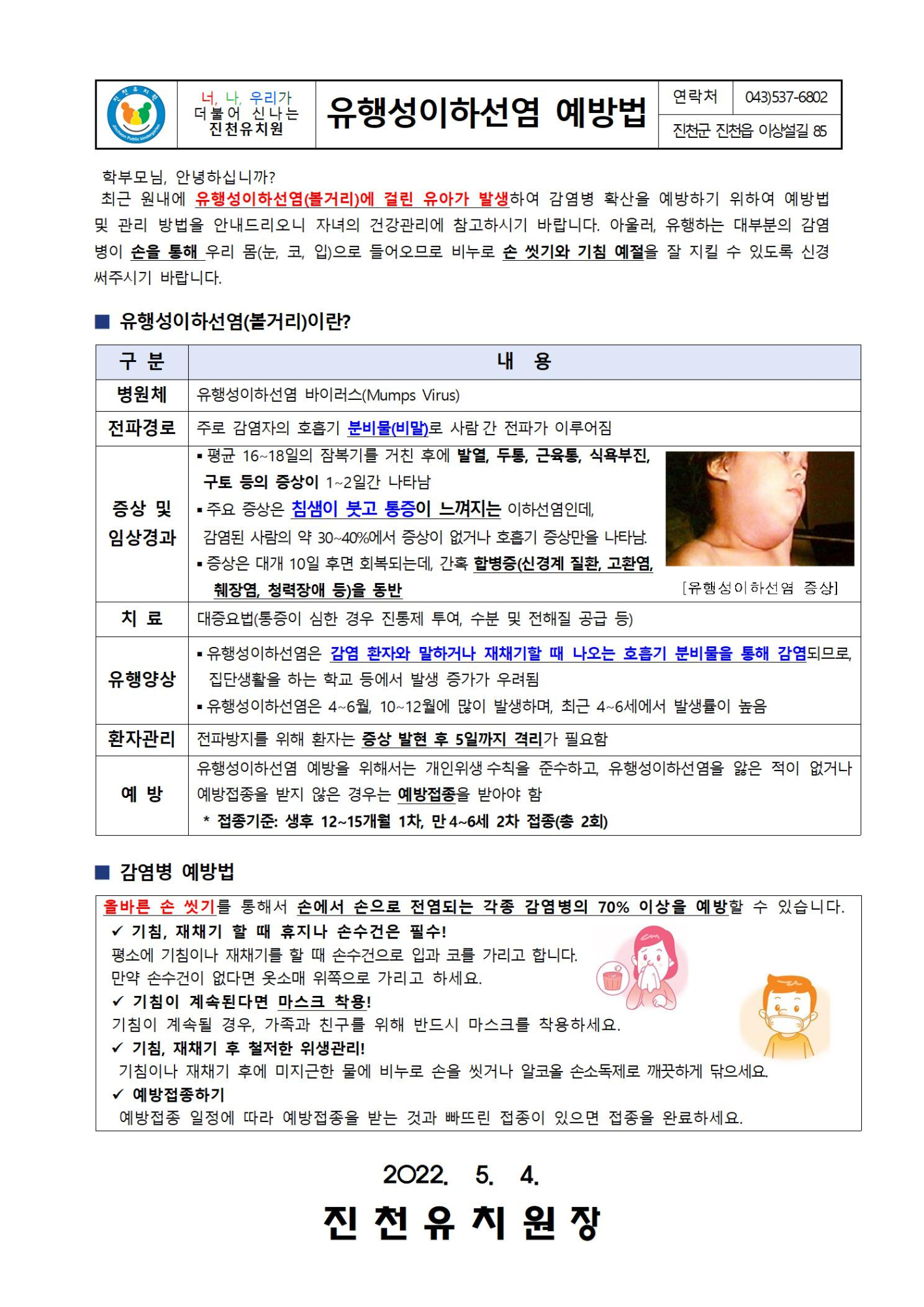유행성이하선염 예방법001