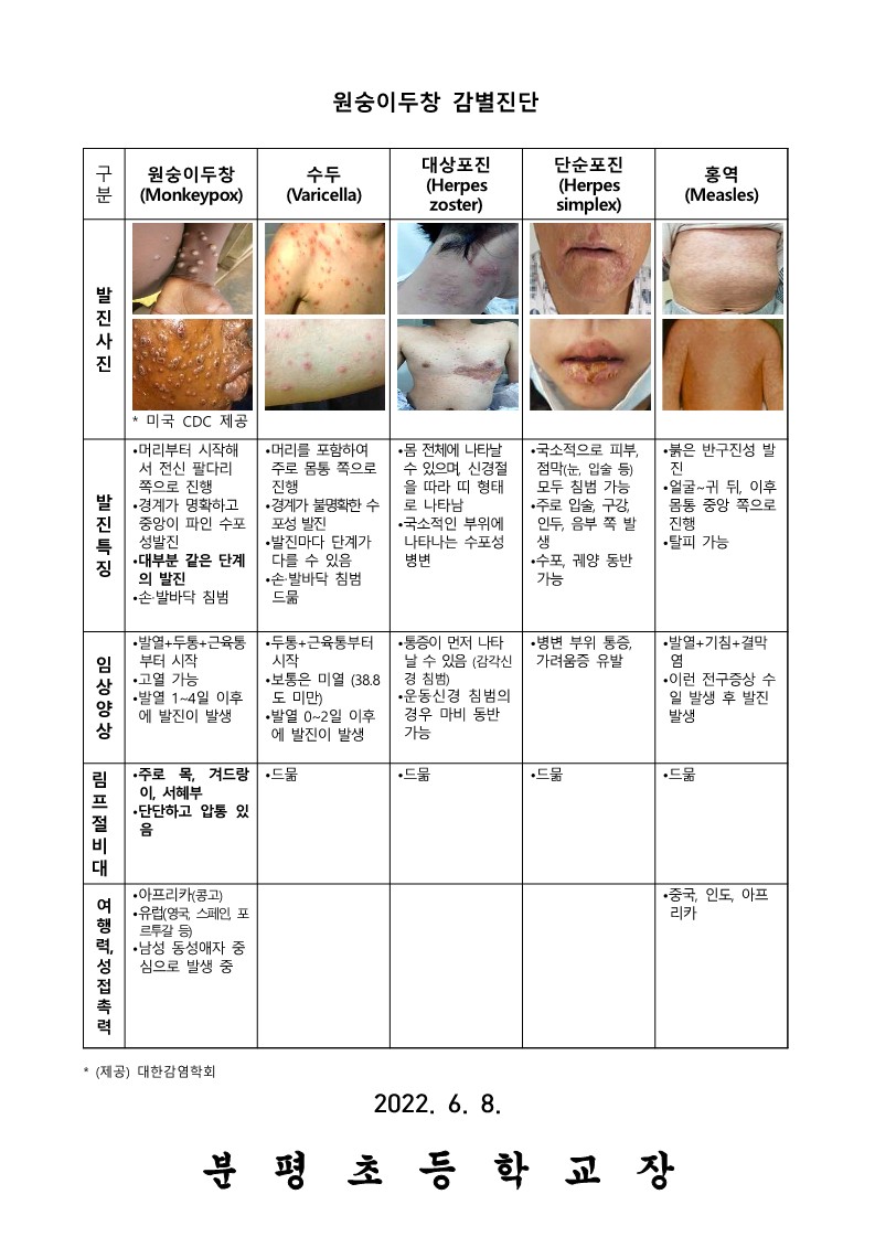 국외 원숭이두창 대비, 위기경보 “관심단계” 발령_2