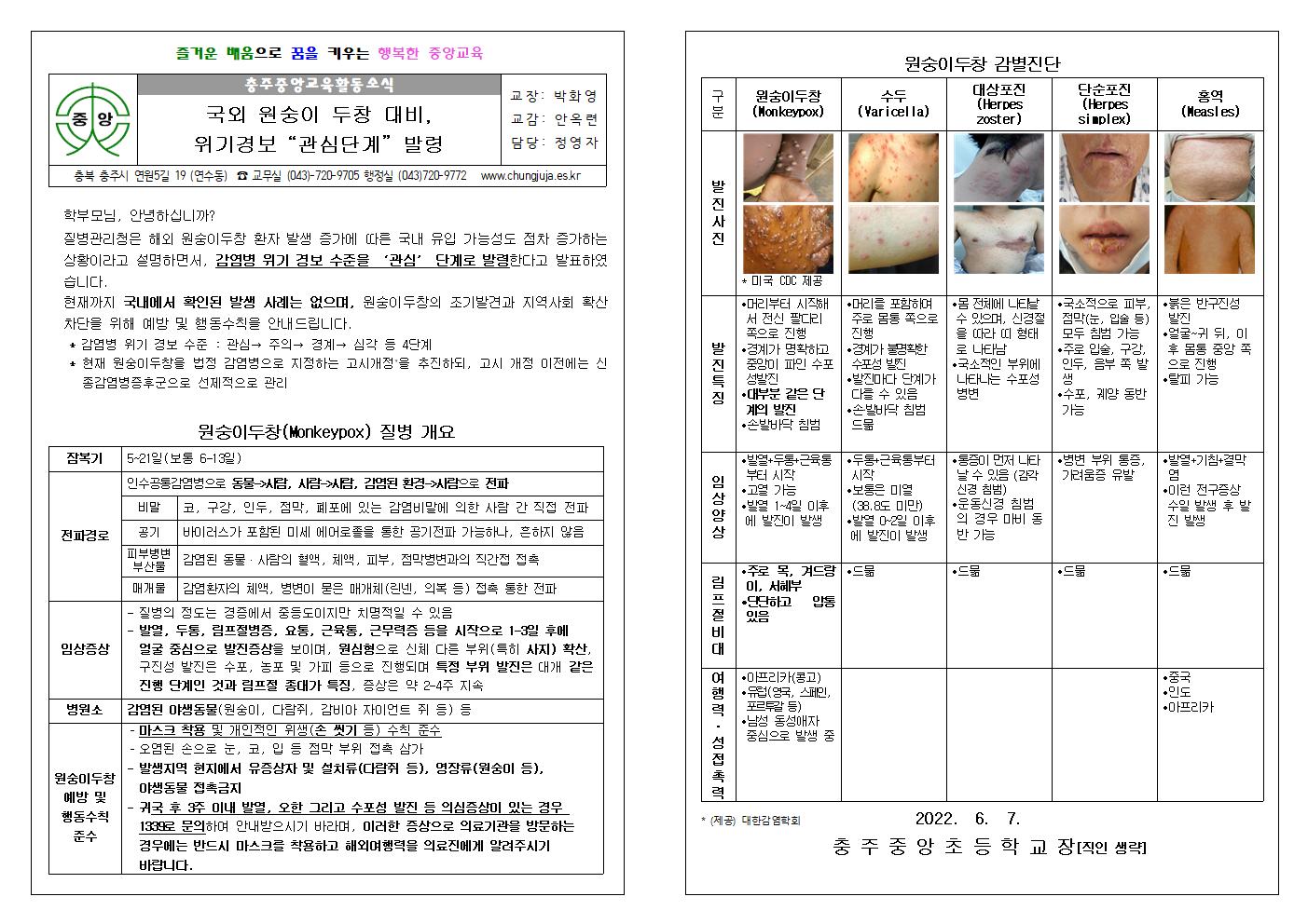 원숭이 두창 대비, 위기경보 “관심단계” 발령.001