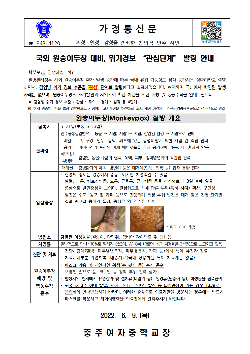 국외 원숭이두창 대비, 위기경보 관심단계 발령 안내 가정통신문001