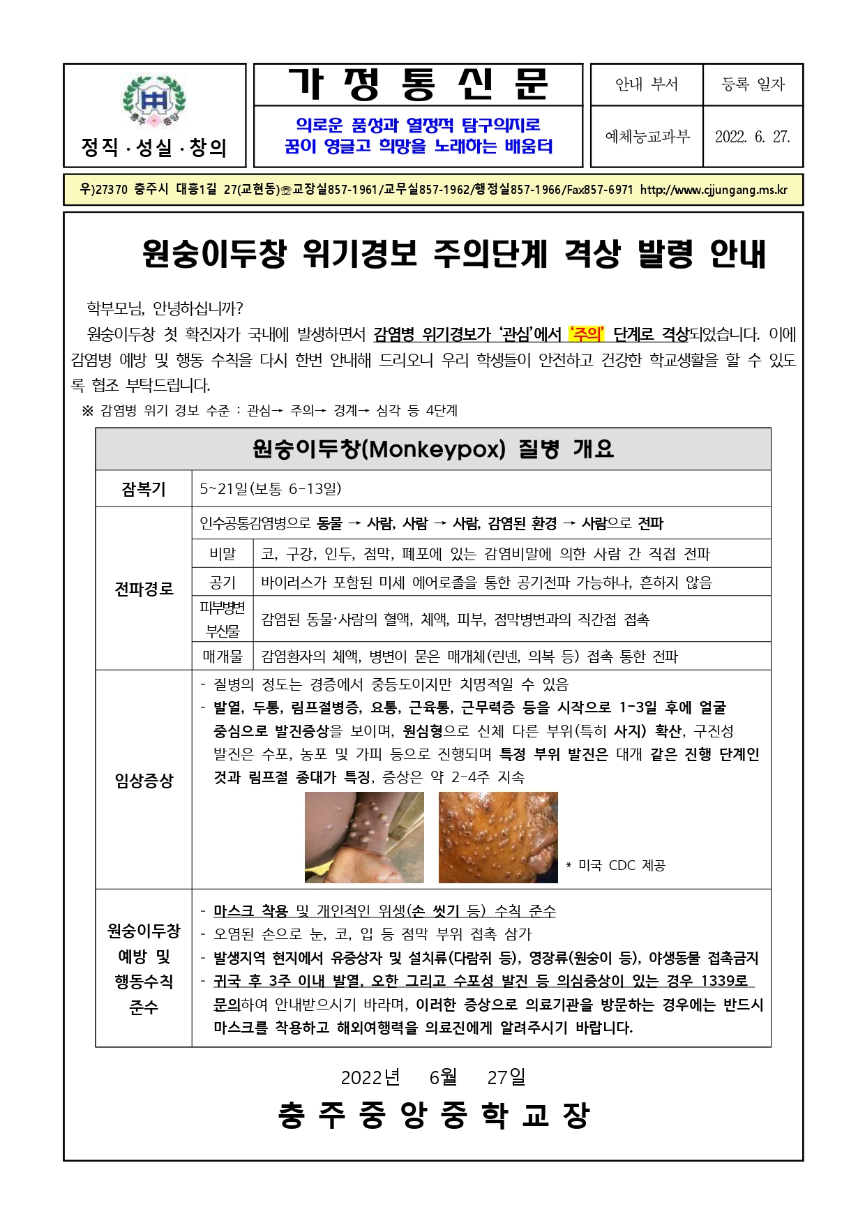 원숭이두창 위기경보 주의단계 격상 발령 안내_page-0001