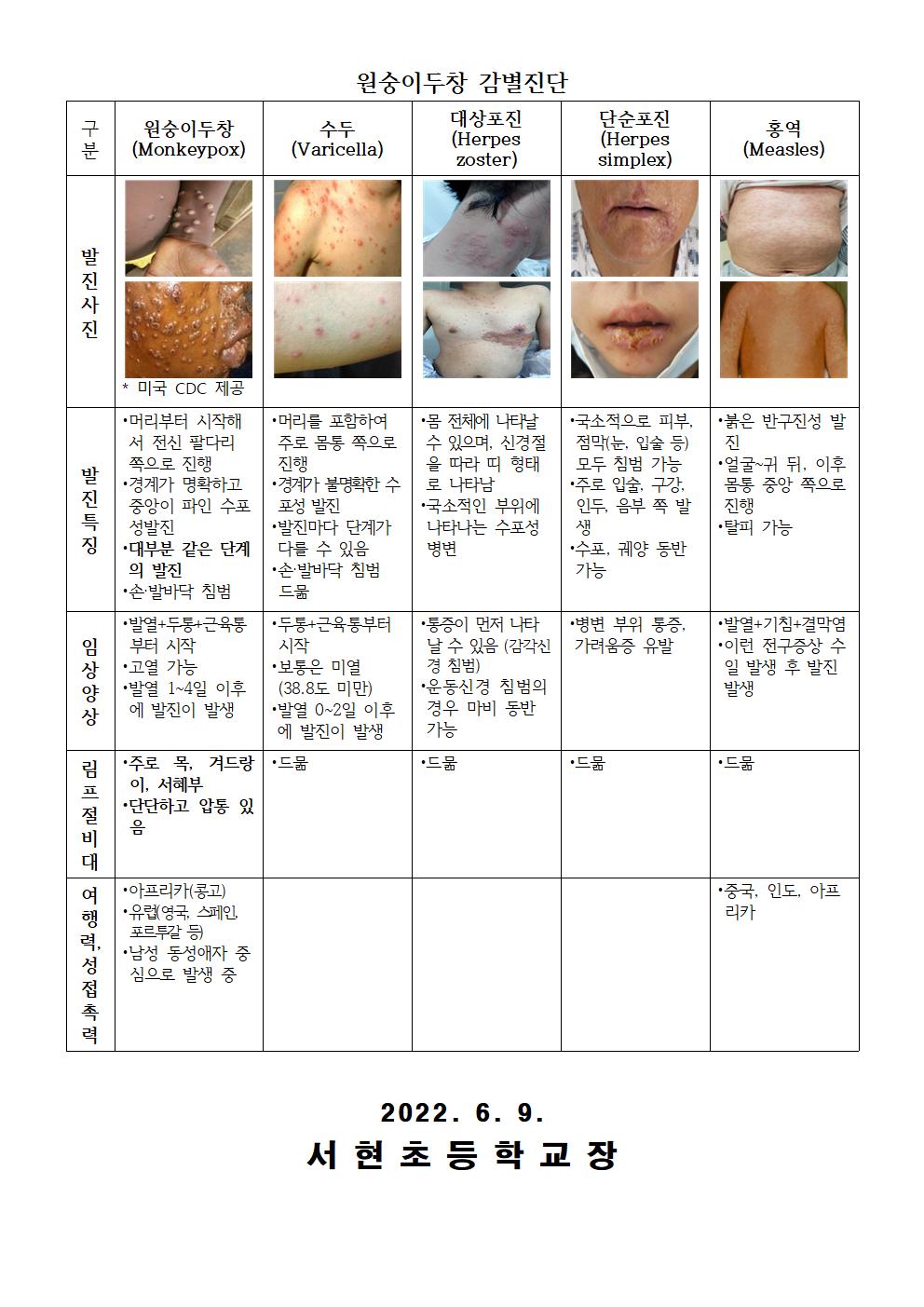 국외 원숭이두창 대비,위기경보 관심단계 발령 안내문002