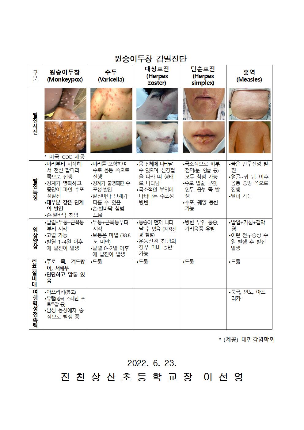 원숭이두창 위기경보 주의단계 격상 발령 안내002