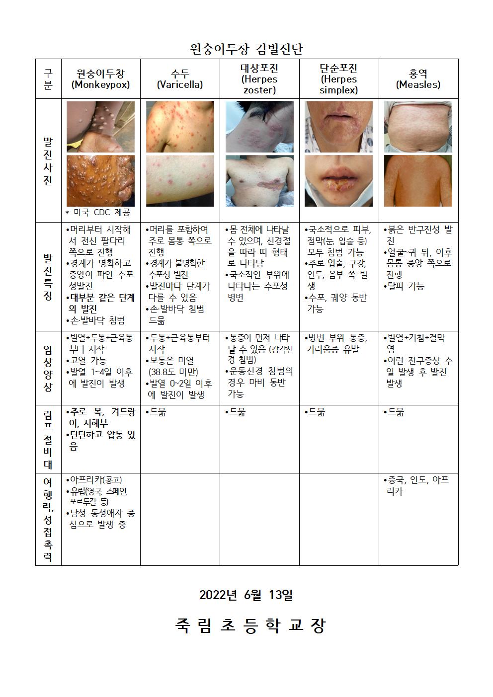 국외 원숭이두창 대비, 감염병 위기경보 관심 단계 발령002