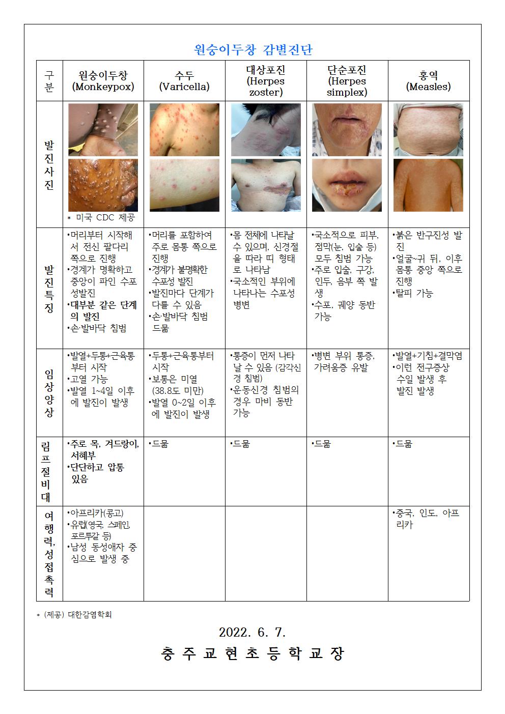 원숭이 두창 대비 위기경보 “관심단계” 발령 안내문002