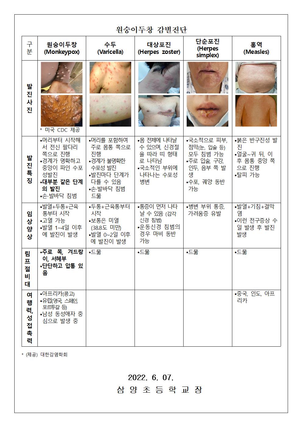 원숭이 두창 대비, 위기경보 “관심단계” 발령002