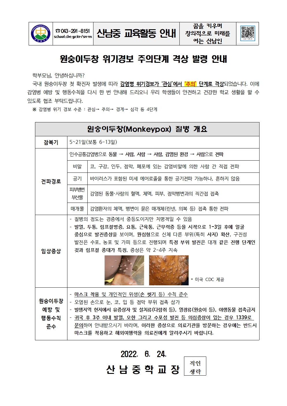 원숭이두창 위기경보 주의단계 격상 발령 안내 가정통신문001