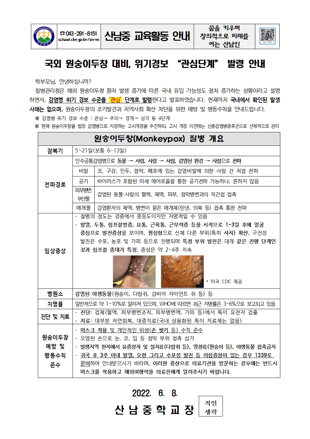 국외 원숭이두창 대비 위기경보 관심단계 발령 안내 가정통신문001