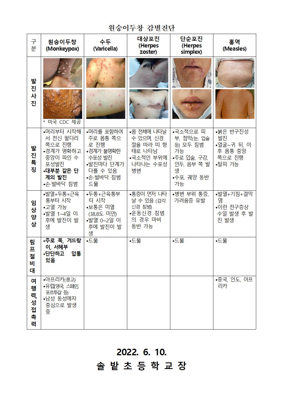 국외 원숭이 두창 대비, 위기경보 관심단계 발령 안내문002