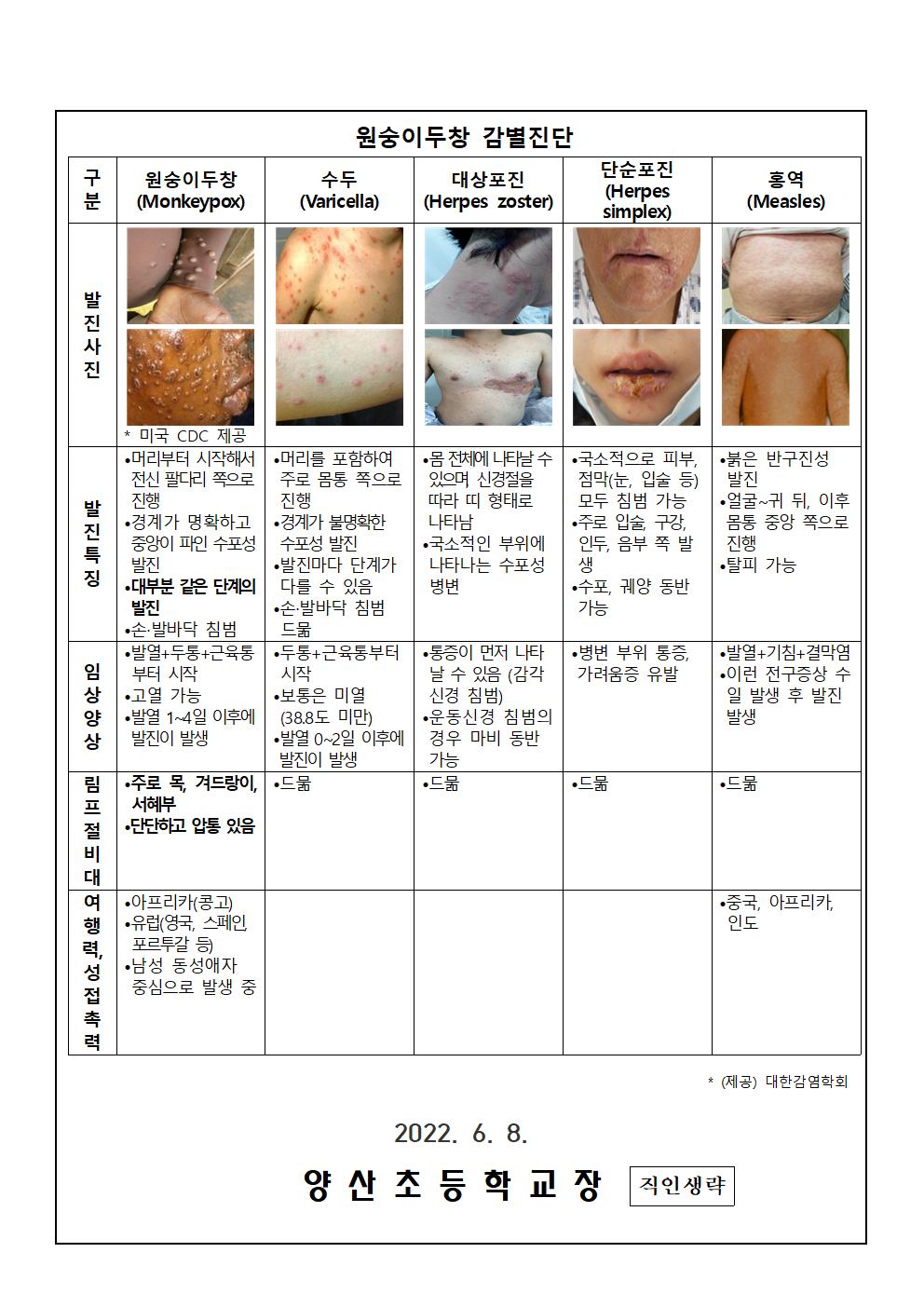 국외 원숭이 두창 대비, 위기경보 관심단계 발령 안내장002