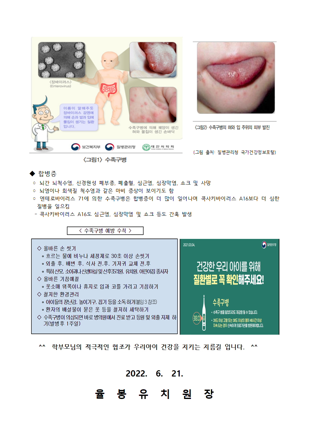 수족구 예방관리 안내002