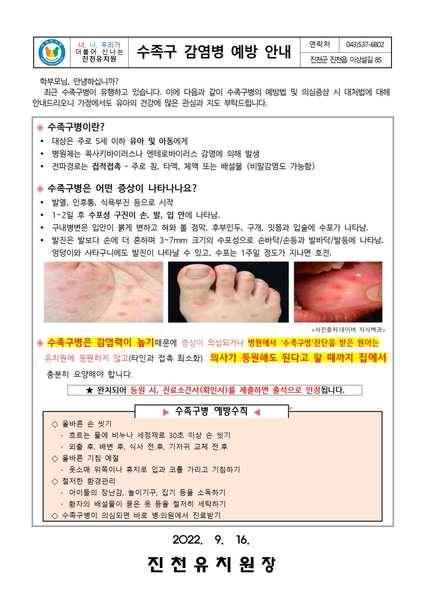 수족구 감염병 예방 안내001