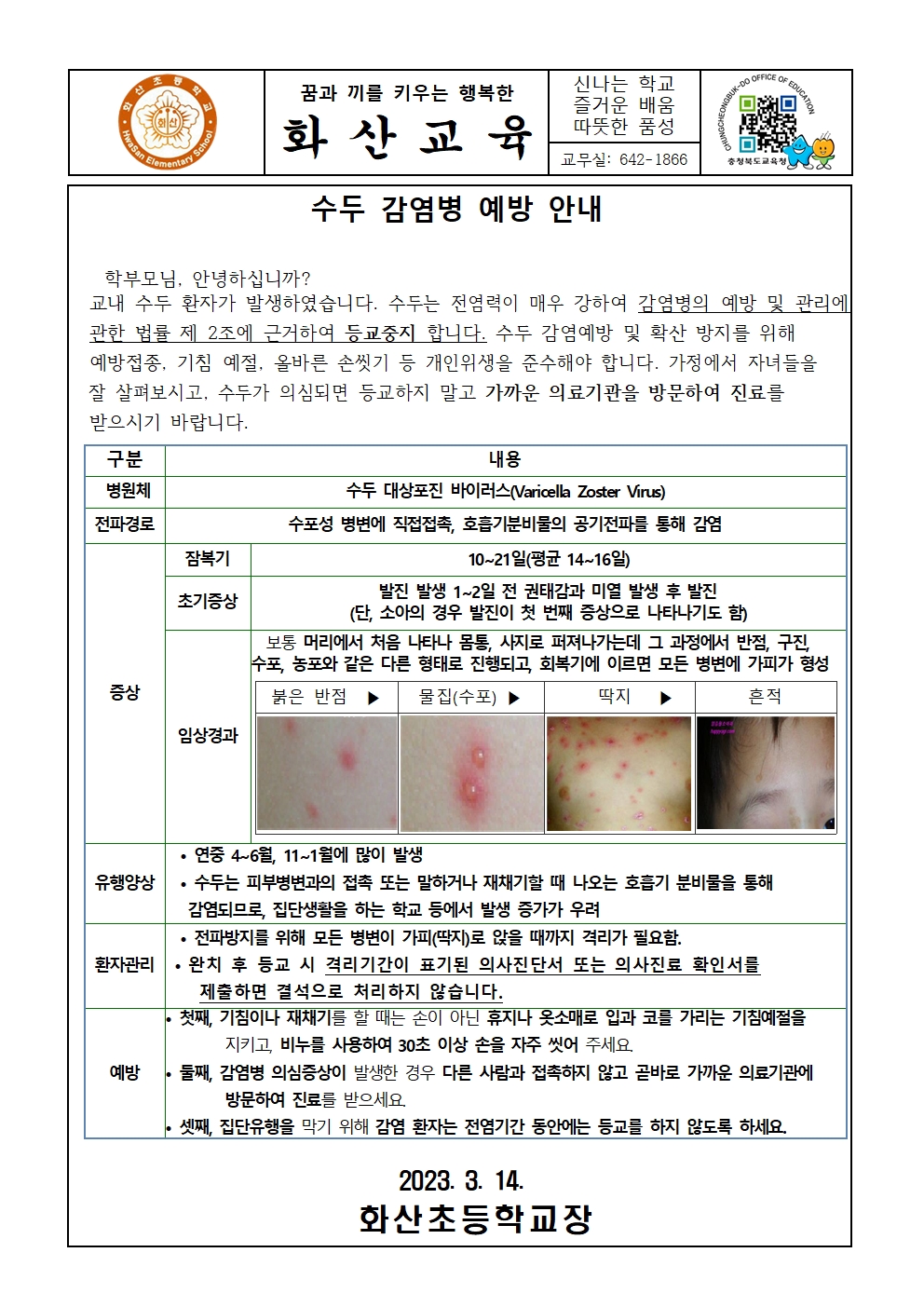 수두 감염병 예방 안내문001