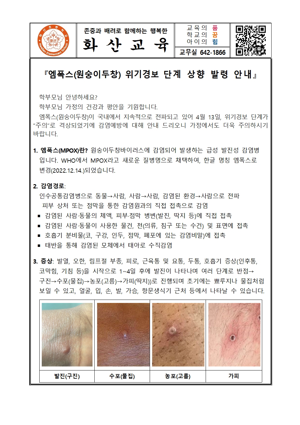 엠폭스(원숭이두창)위기경보격상 안내 001