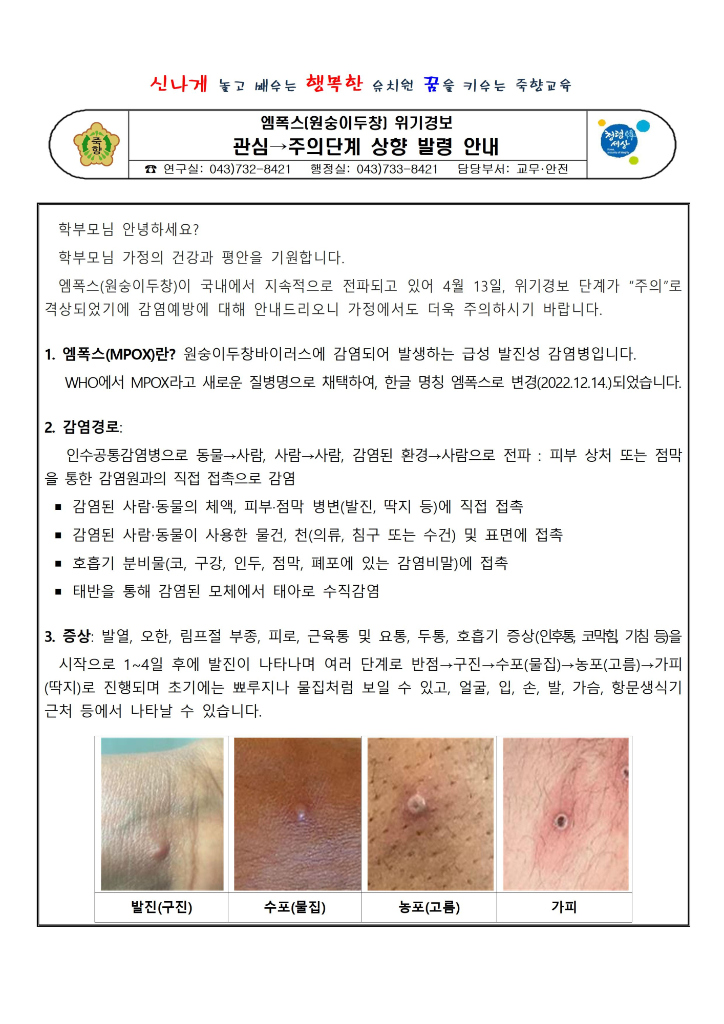 2023. 엠폭스[원숭이두창] 위가경보 주의단계 상향 발령 안내001