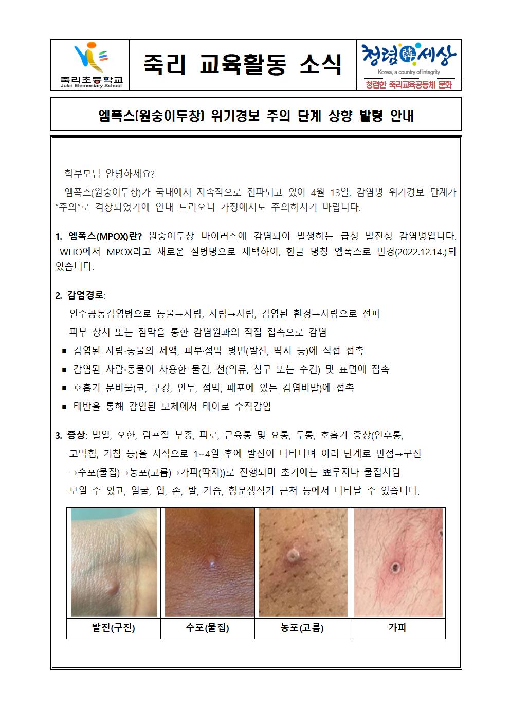 엠폭스위기경보격상안내문001