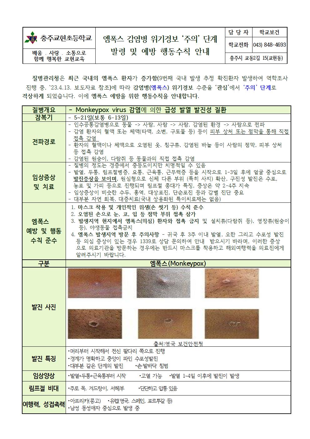 23-엠폭스 감염병 위기경보 ‘주의 단계’ 격상 발령 및 예방 행동수칙 안내001