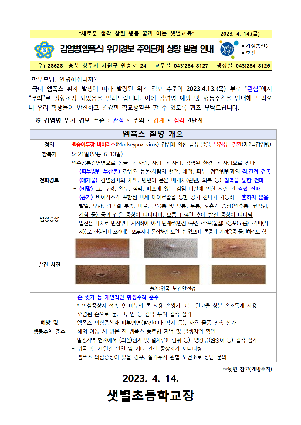 감염병(엠폭스) 위기경보 단계 상향 발령 안내(210414)001