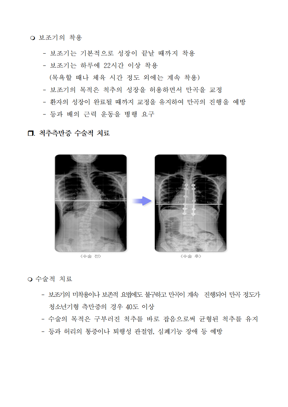 2023_척추옆굽음증사전교육자료005