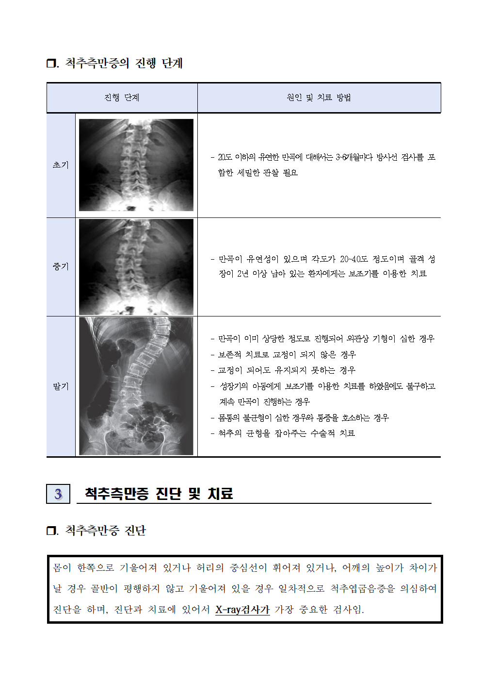 2023_척추옆굽음증사전교육자료003