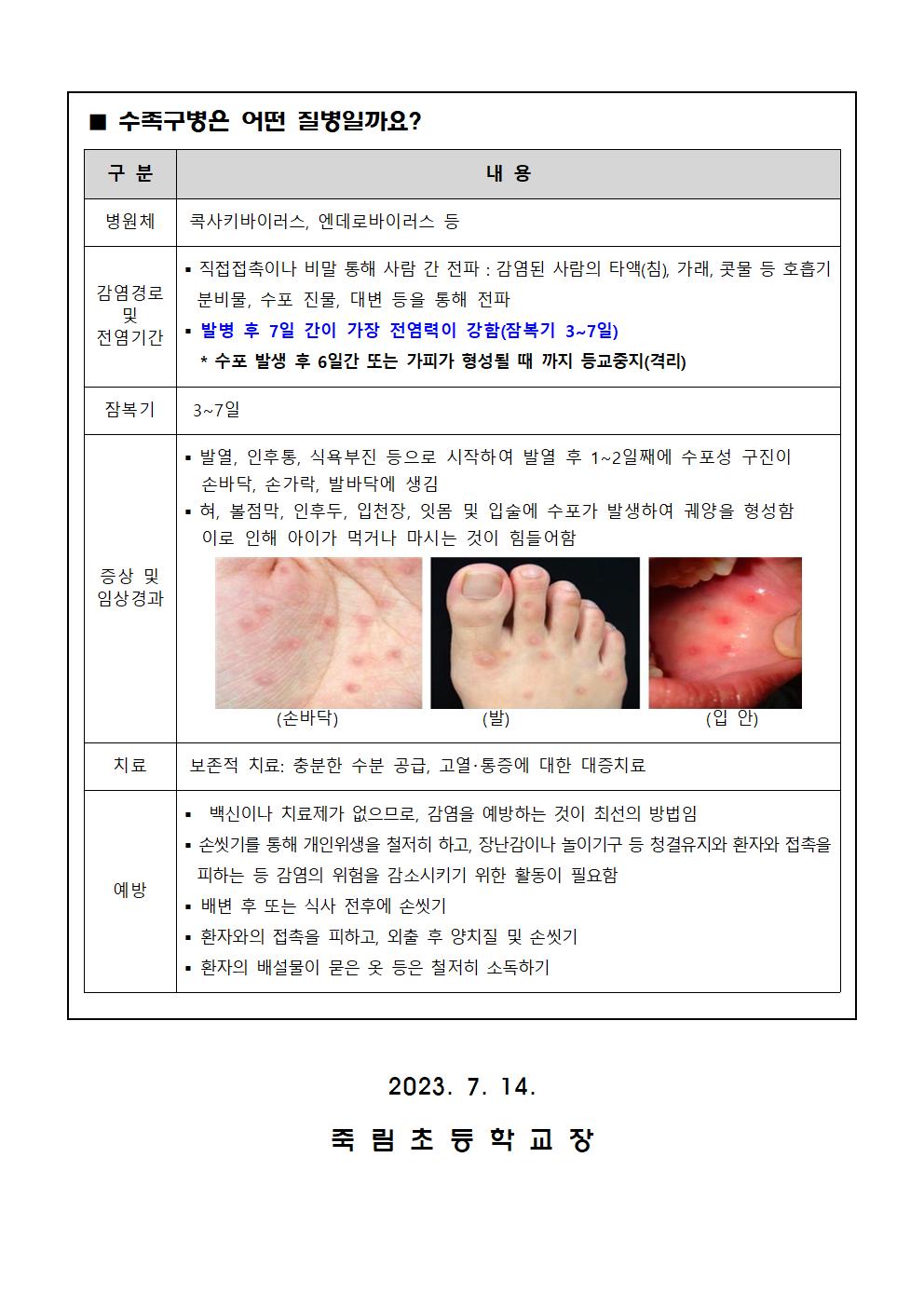 2023. 수두 및 유행성이하선염(볼거리)과 수족구병 예방 안내문003