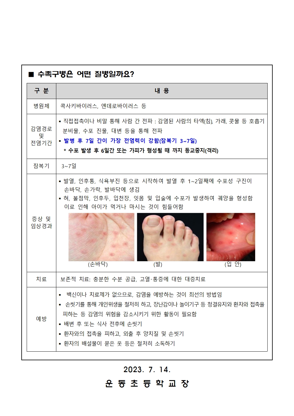 2023. 수두 및 유행성이하선염(볼거리)과 수족구병 예방 안내문003