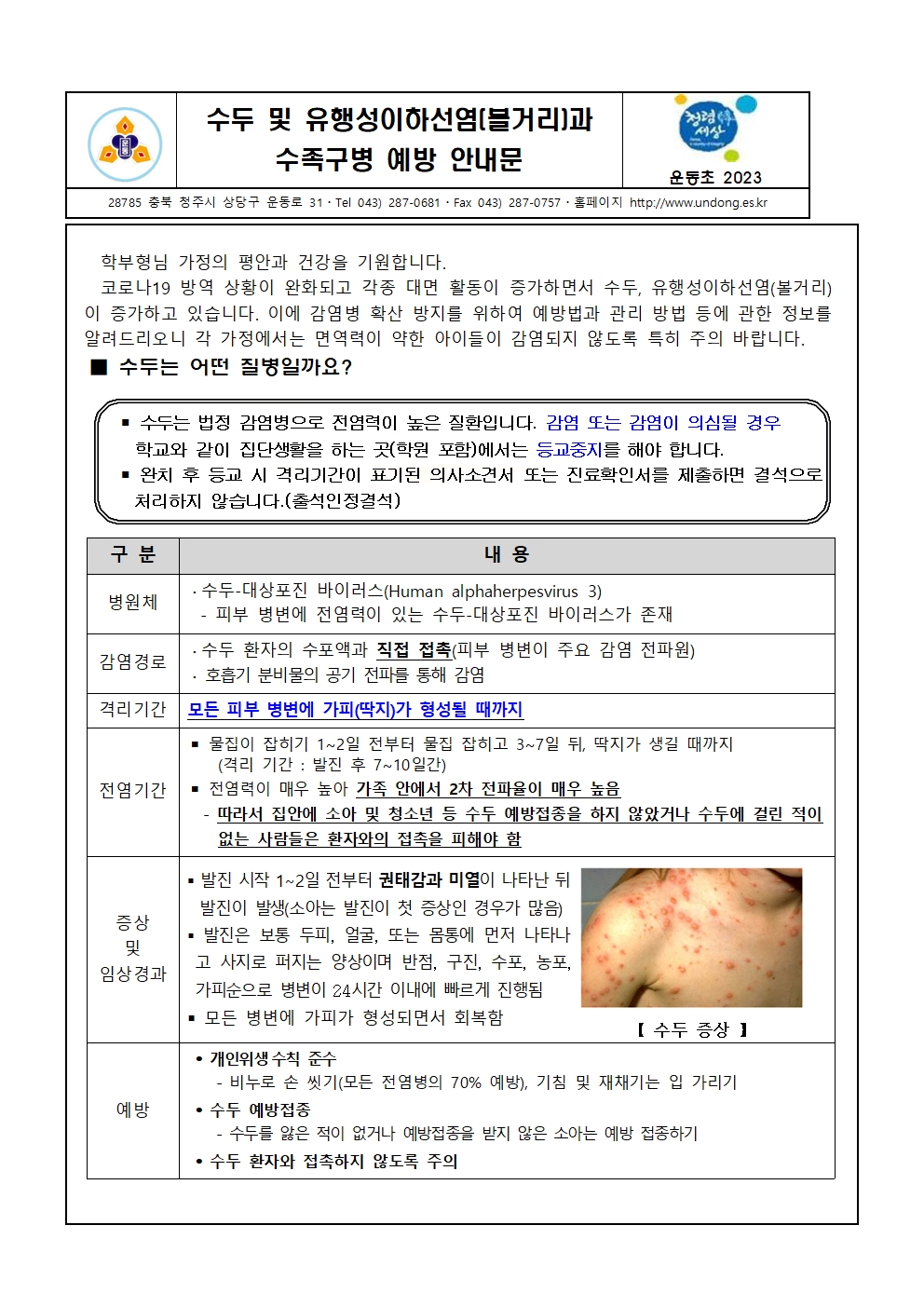 2023. 수두 및 유행성이하선염(볼거리)과 수족구병 예방 안내문001