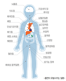 흡연1