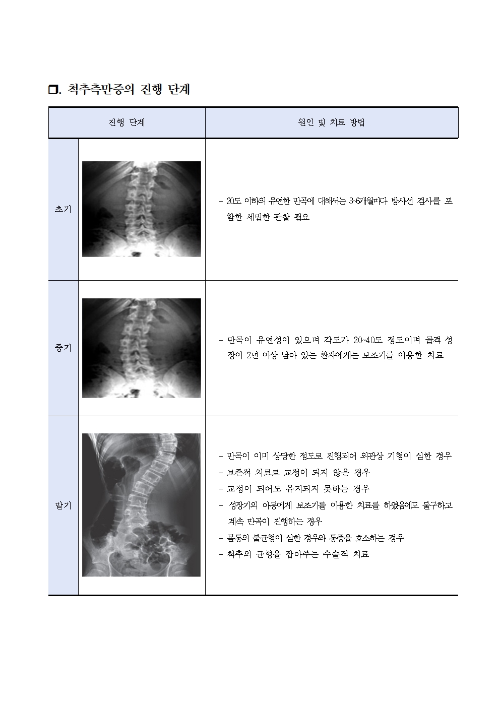 6학년 대상 척추측만증 검진 안내005