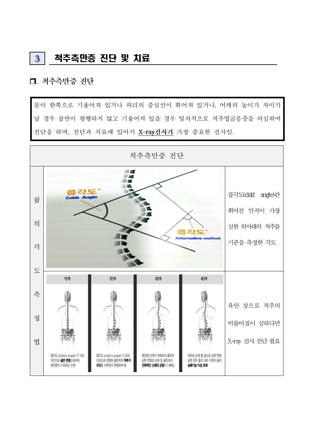 6학년 대상 척추측만증 검진 안내006