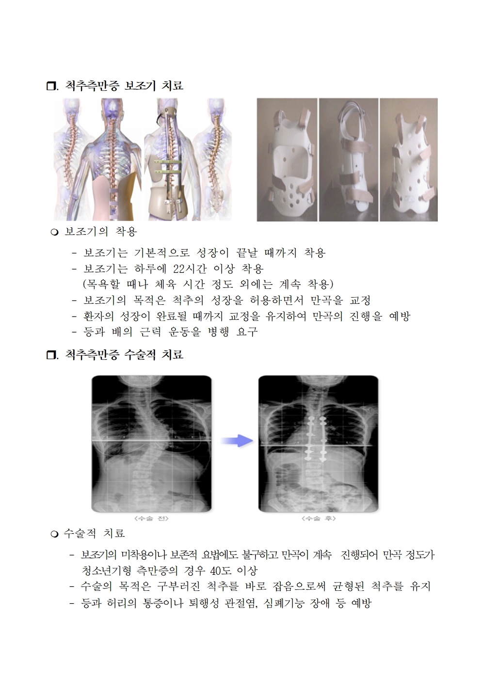 6학년 대상 척추측만증 검진 안내007