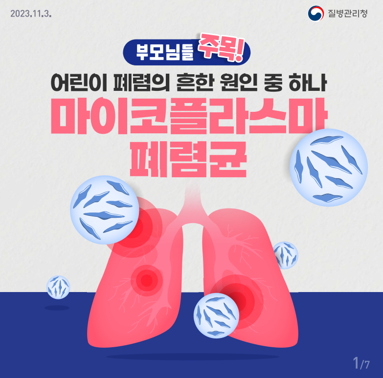 마이코플라스마 폐렴균 예방(1)