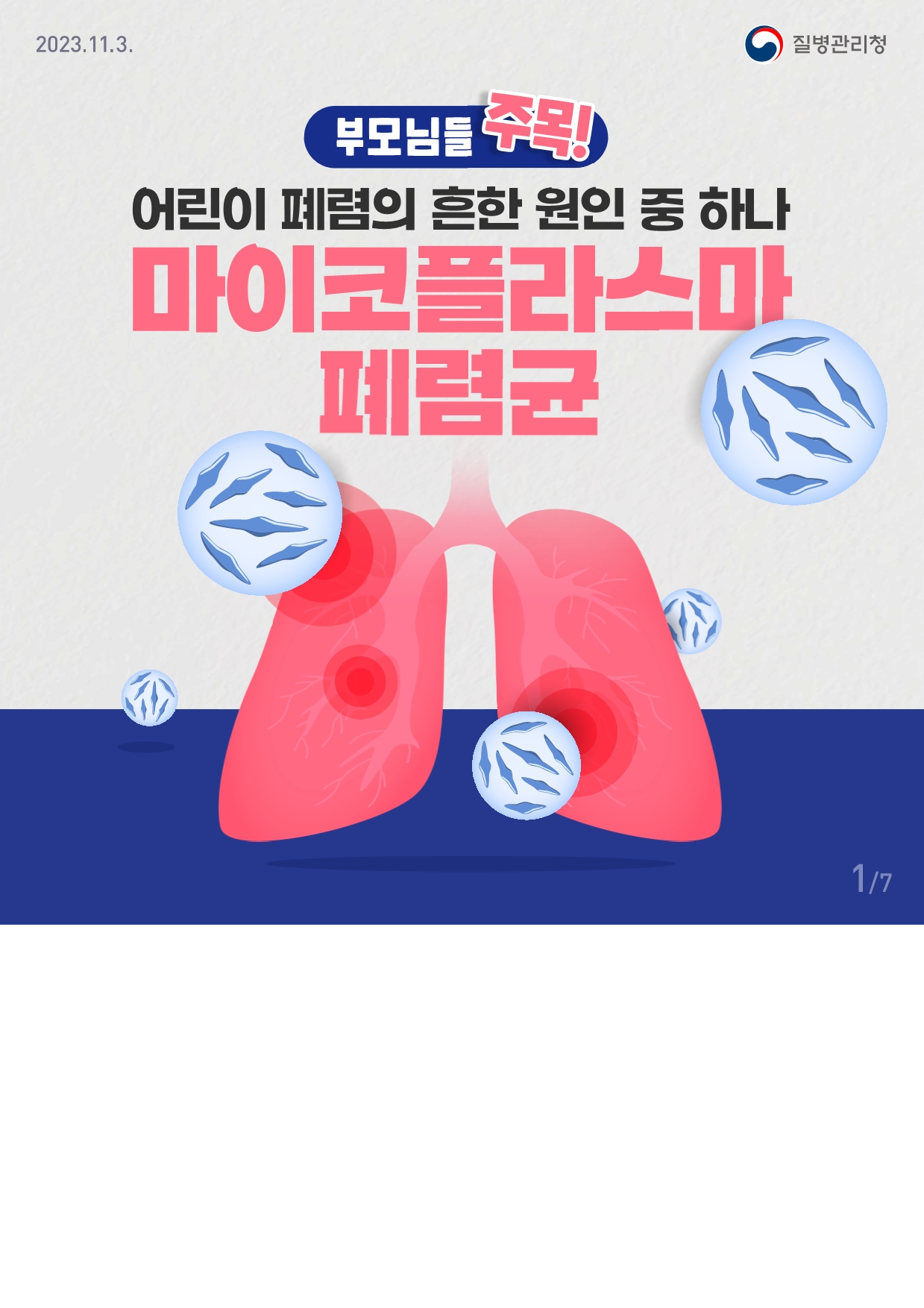 마이코플라스마 폐렴균 감염증 카드뉴스1