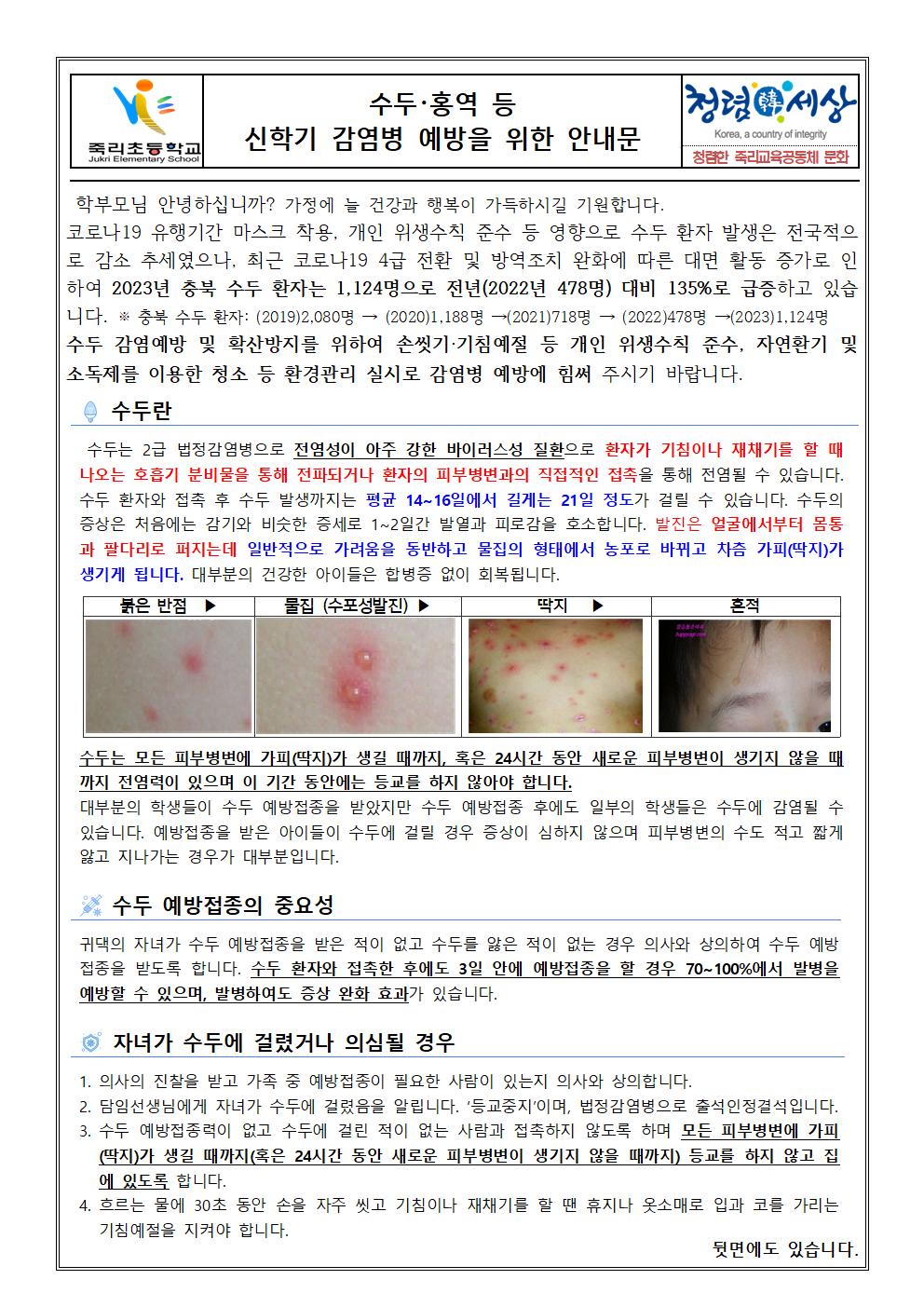 수두 홍역 등 신학기 감염병 예방을 위한 안내문001
