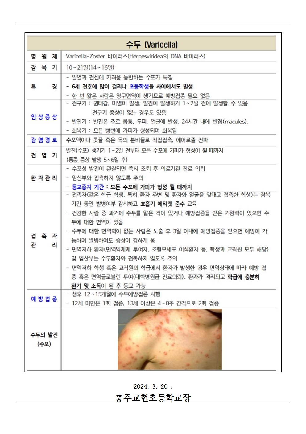 홍역,수두 등 호흡기 감염병 예방 안내문002