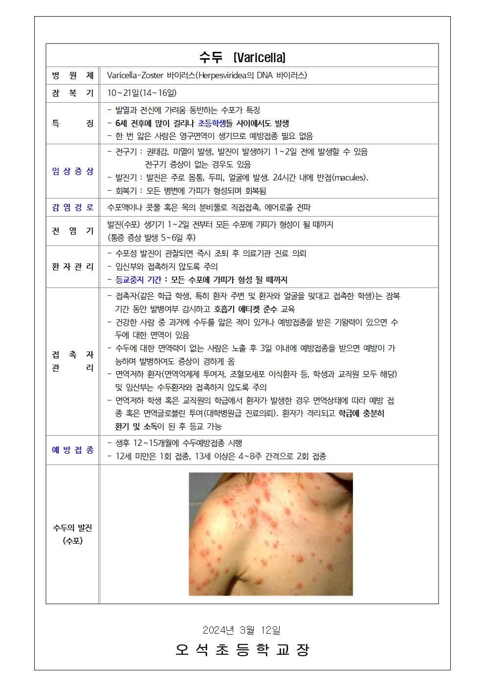 신학기 감염병(홍역,수두)예방 안내문002