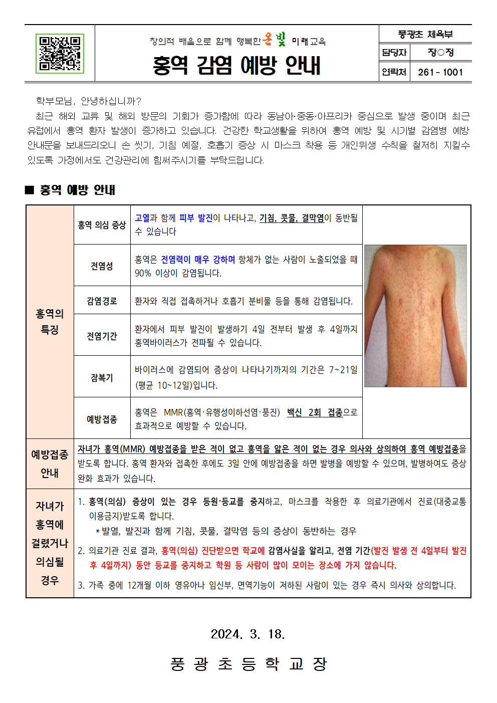 홍역 감염 예방 안내001