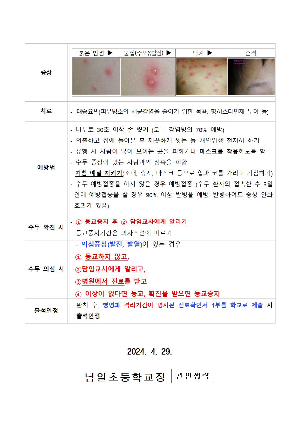 2024. 수두 예방 안내문002