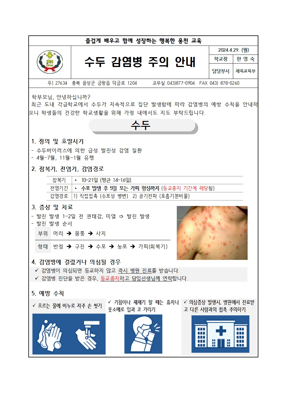 수두 감염병 주의 안내001