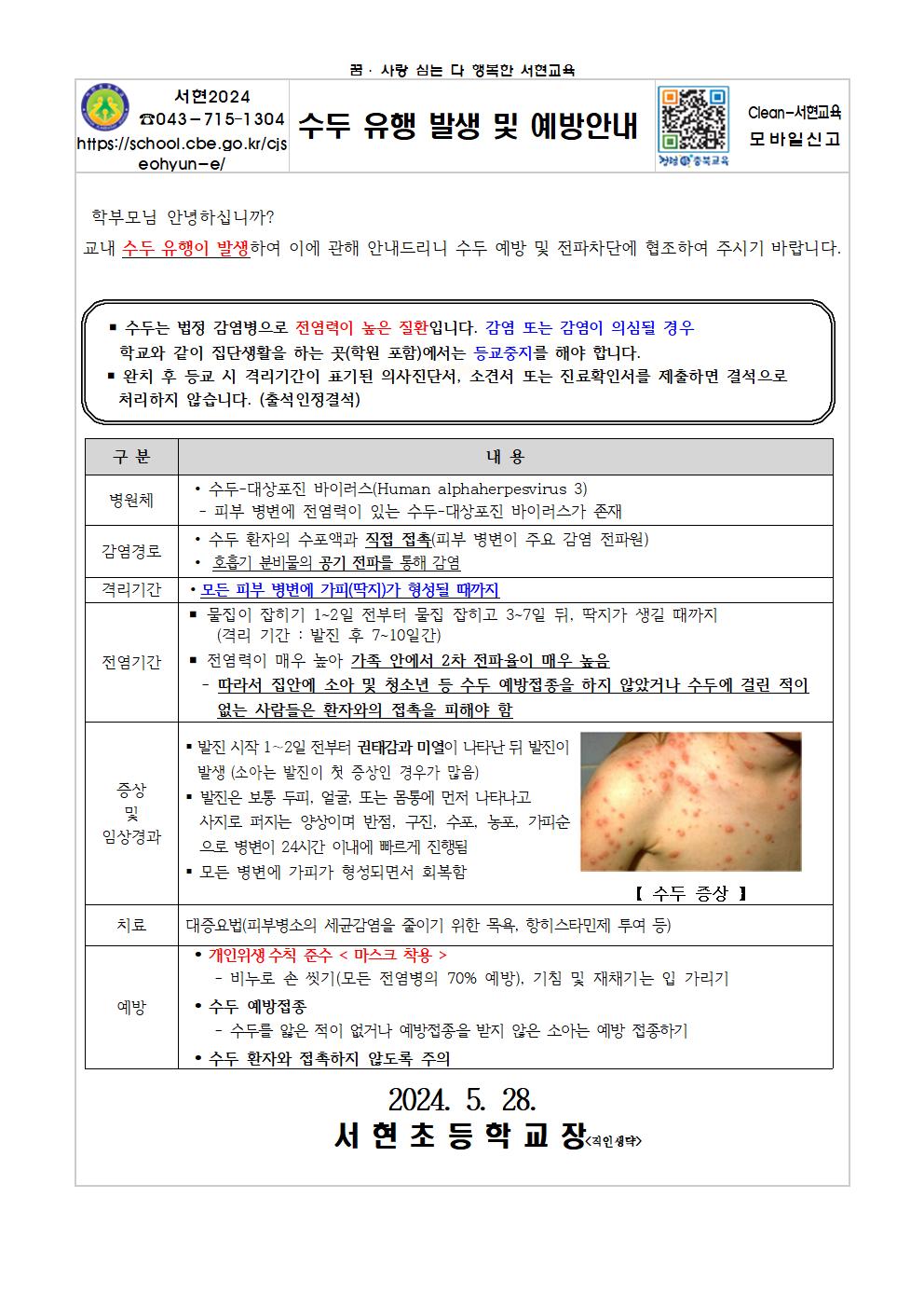 수두유행 발생 및 예방 안내문001