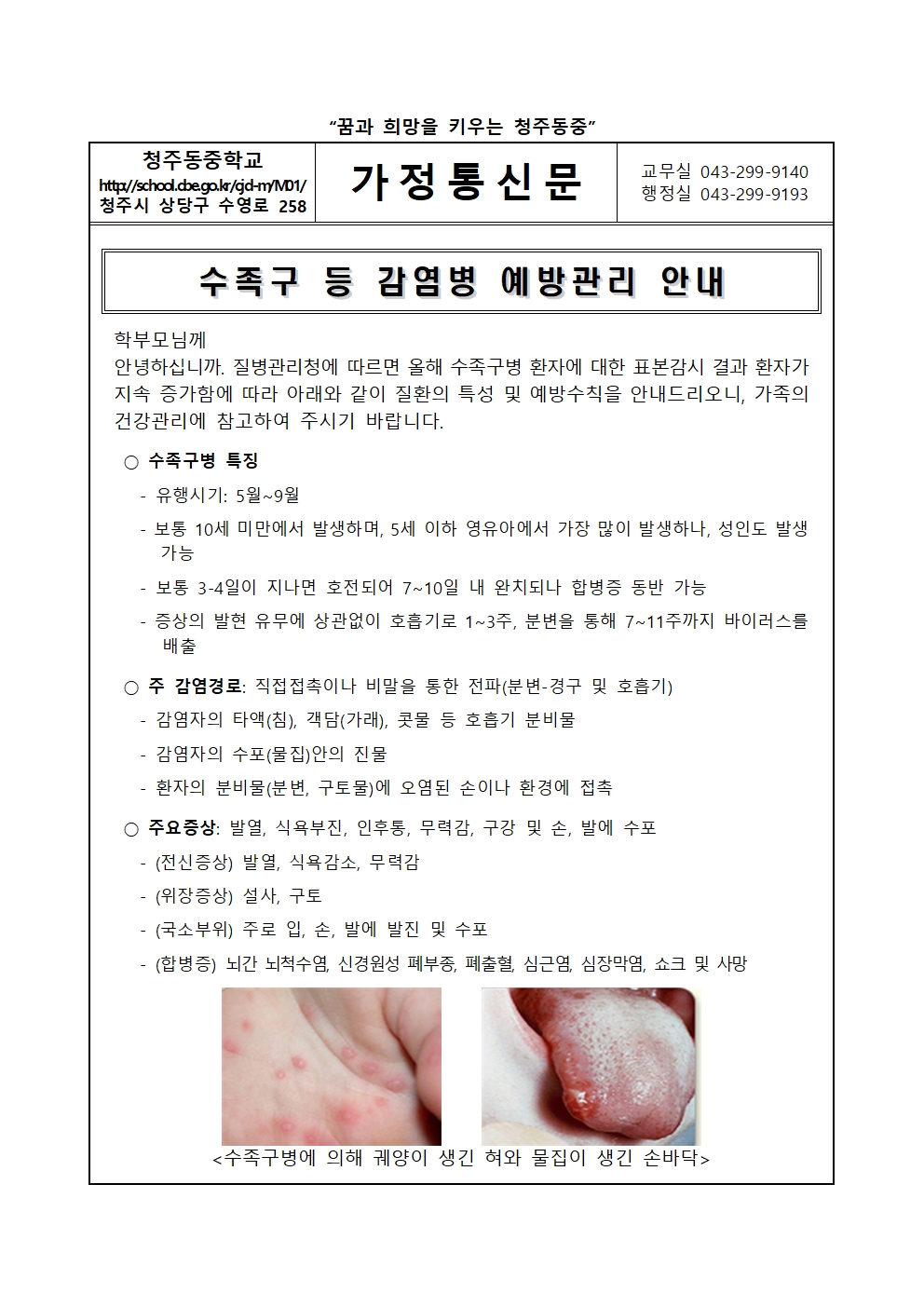 수족구 등 감염병 예방관리 안내001